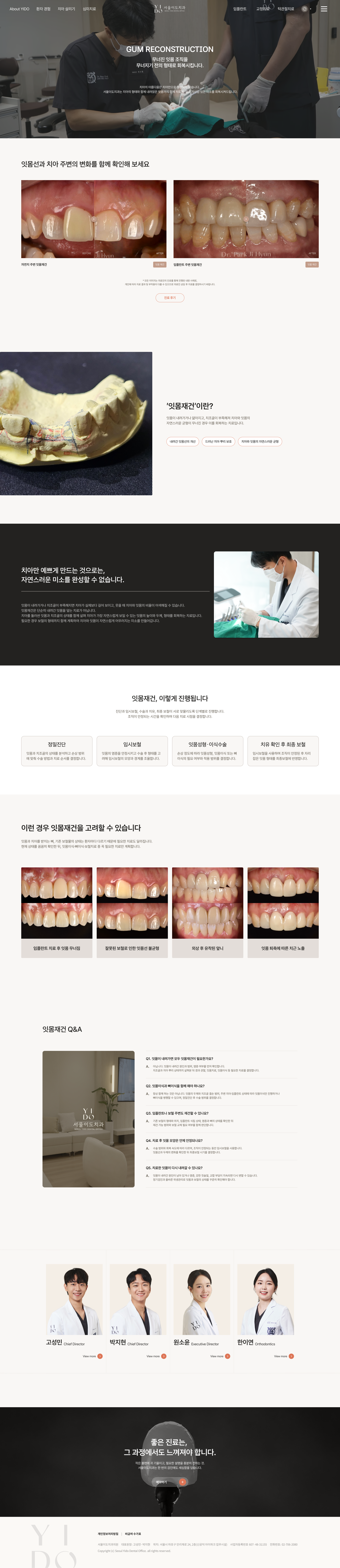잇몸재건